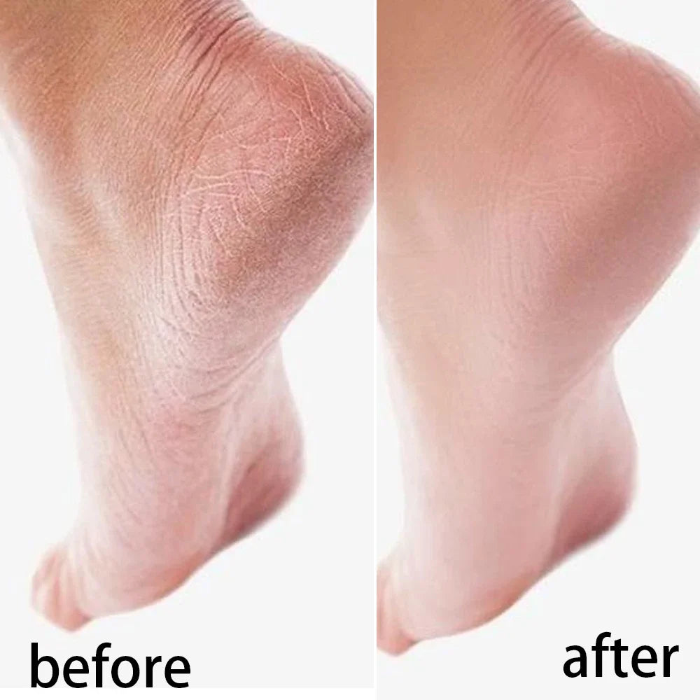 Silicone Moisturizing Mask Socks Reusable Exfoliating Anti Crack Protective Gloves Dry Dead Skin Remover Tools Hand Foot Care