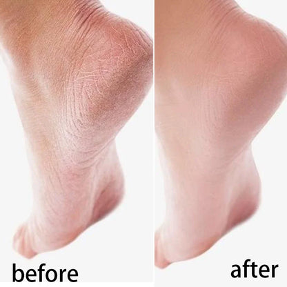 Silicone Moisturizing Mask Socks Reusable Exfoliating Anti Crack Protective Gloves Dry Dead Skin Remover Tools Hand Foot Care