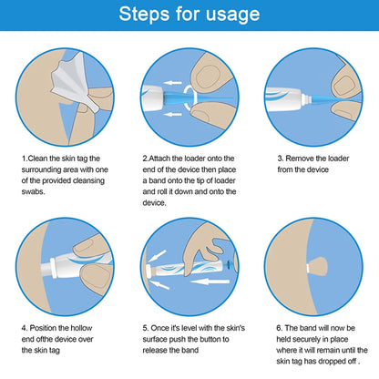 2-IN-1 Auto Skin Tag Removal Tool Kit Painless Skin Label Mole Acne Wart Removal Pen with Cleansing Swabs Facial Skin Care Tool