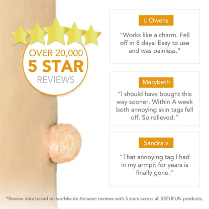 Simple Wart Removal Tool Set Skin Tag Removeal Tool Easy To Clean Skin Care Tool Skin Tag Removal Care Products