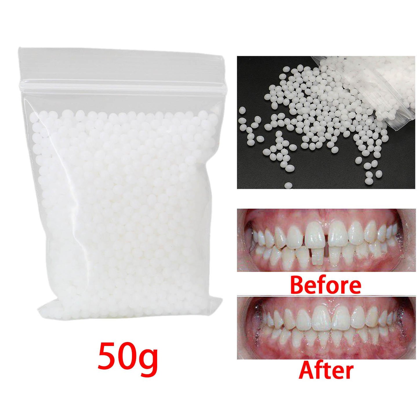50G Temporary Tooth Repair Kit Teeth Gaps Filling Fix Missing Broken Teeth Moldable False Teeth Tooth Repair Teeth Veneers White