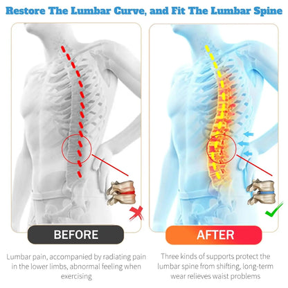 Lumbar Support Back Brace for Lower Back Pain,Back Brace for Men and Women,Back Support Belt with Dual Adjustable Straps