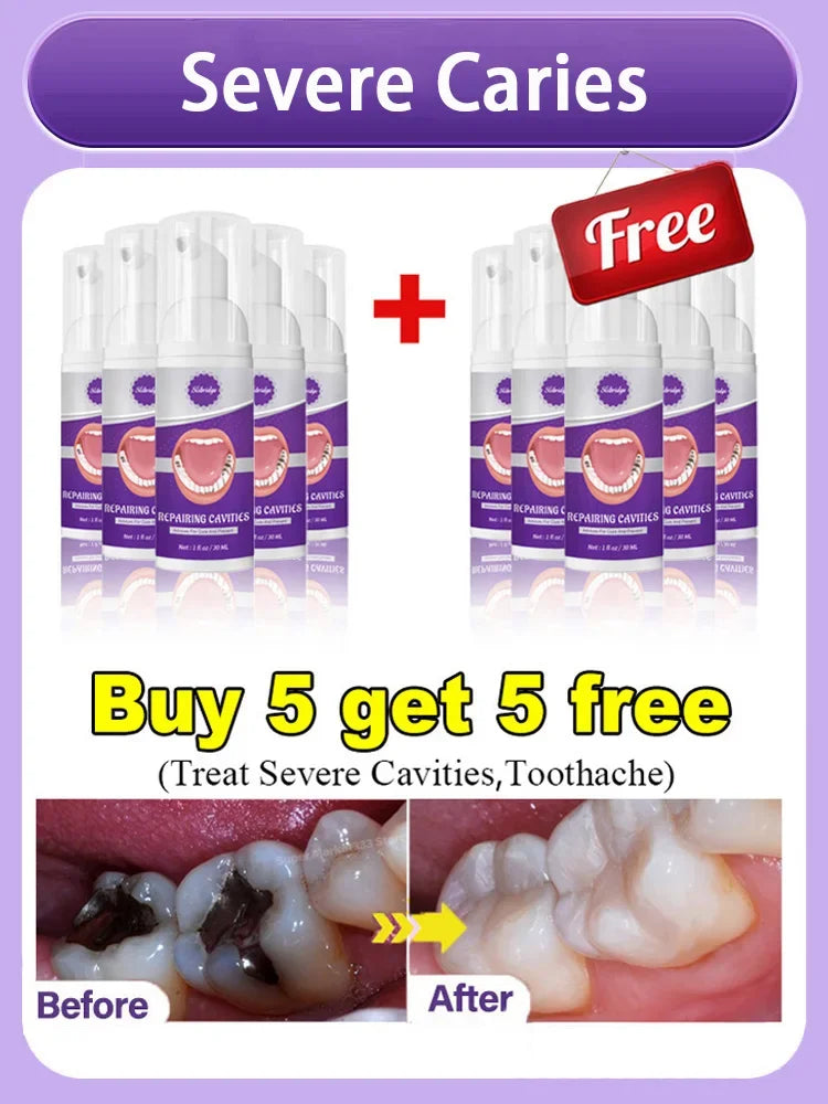 tooth decay repair tooth repair fast teeth whitening clean teeth teeth repair cavities tooth repair treatment