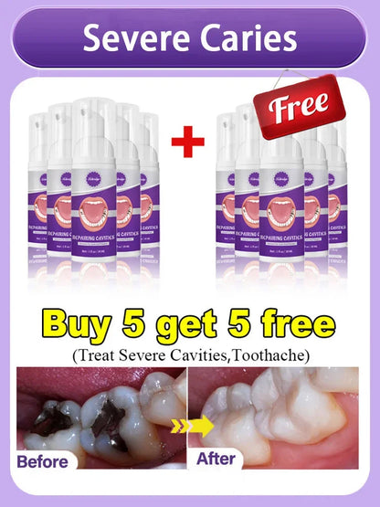 tooth decay repair tooth repair fast teeth whitening clean teeth teeth repair cavities tooth repair treatment