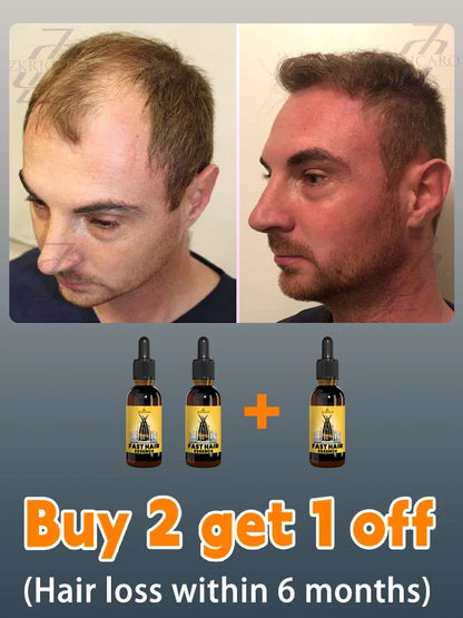 2025 Hair growth oil, repair baldness, hairline, rapid hair growth hair growth oil for men