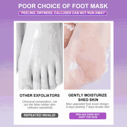2-10pair Exfoliating Foot Mask Foot Care Tools For Remove Dead Skin Calluses Heel Crack Repair Pedicure Socks Foot Skin Care