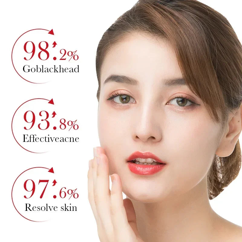 Salicylic Acid Face Cream Acne Creams Mark Repair Firming Moisturizing Blackhead Remover skincare Facial Cream