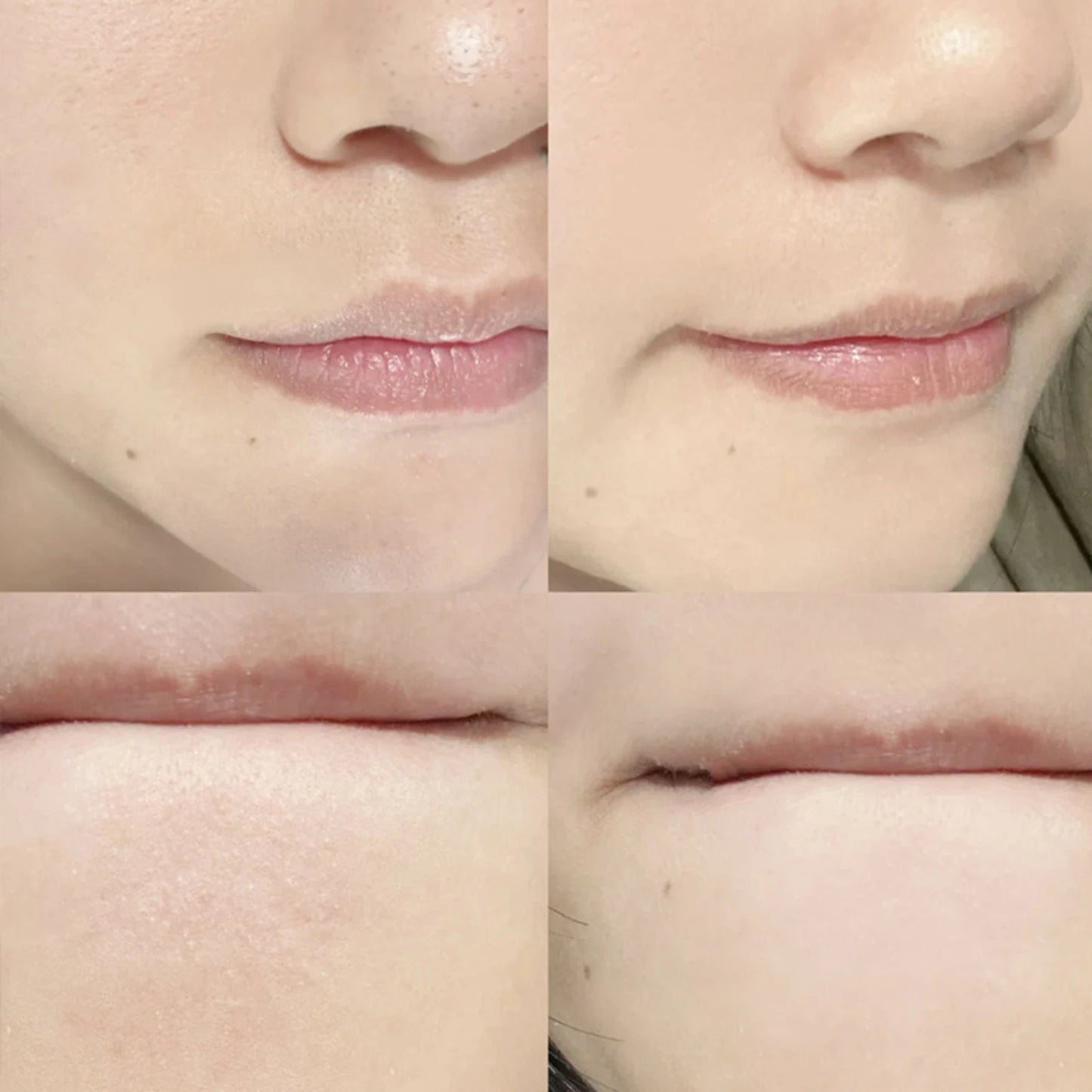 Blackhead Remover Tool Face Skin Care Tools Deeping Clean Master Facial Scrubber Stainless Steel  Pore Cleaner Women Men makeup