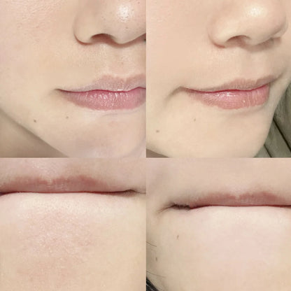 Blackhead Remover Tool Face Skin Care Tools Deeping Clean Master Facial Scrubber Stainless Steel  Pore Cleaner Women Men makeup