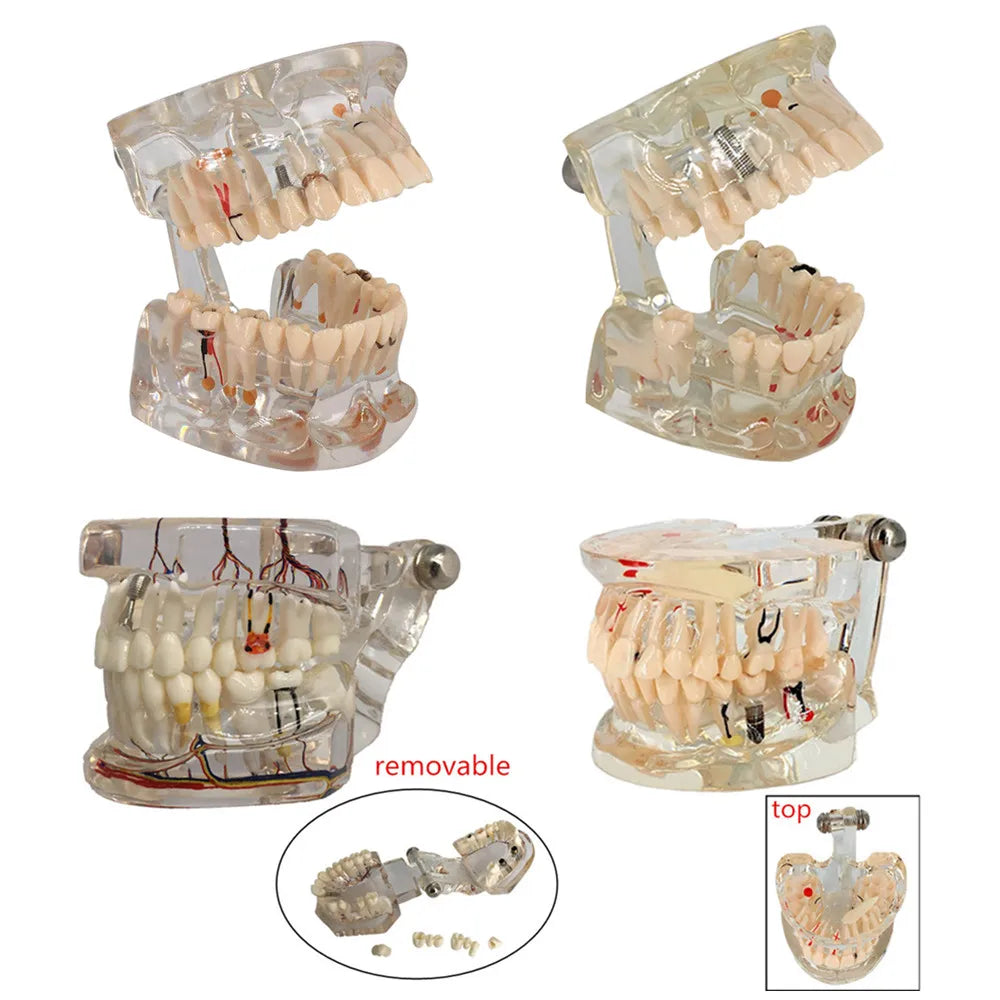 41 Styles Dental Model Teeth Teaching Model Dentist Typodont Orthodontic Jaw Model For Studying   Dentistry Products Accessories