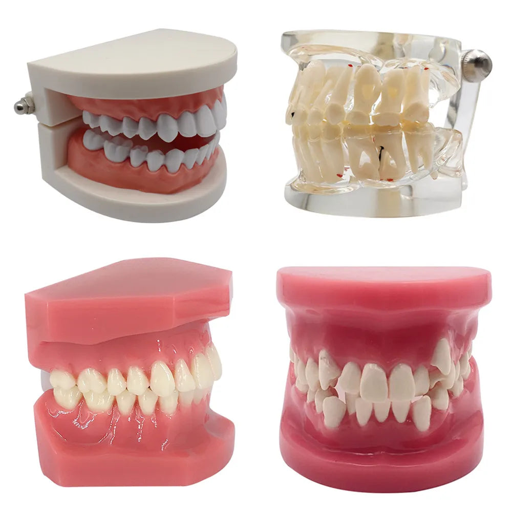 41 Styles Dental Model Teeth Teaching Model Dentist Typodont Orthodontic Jaw Model For Studying   Dentistry Products Accessories