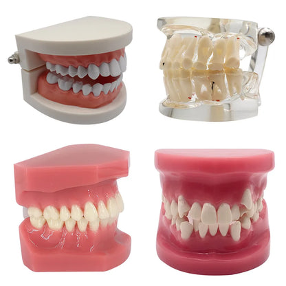 41 Styles Dental Model Teeth Teaching Model Dentist Typodont Orthodontic Jaw Model For Studying   Dentistry Products Accessories