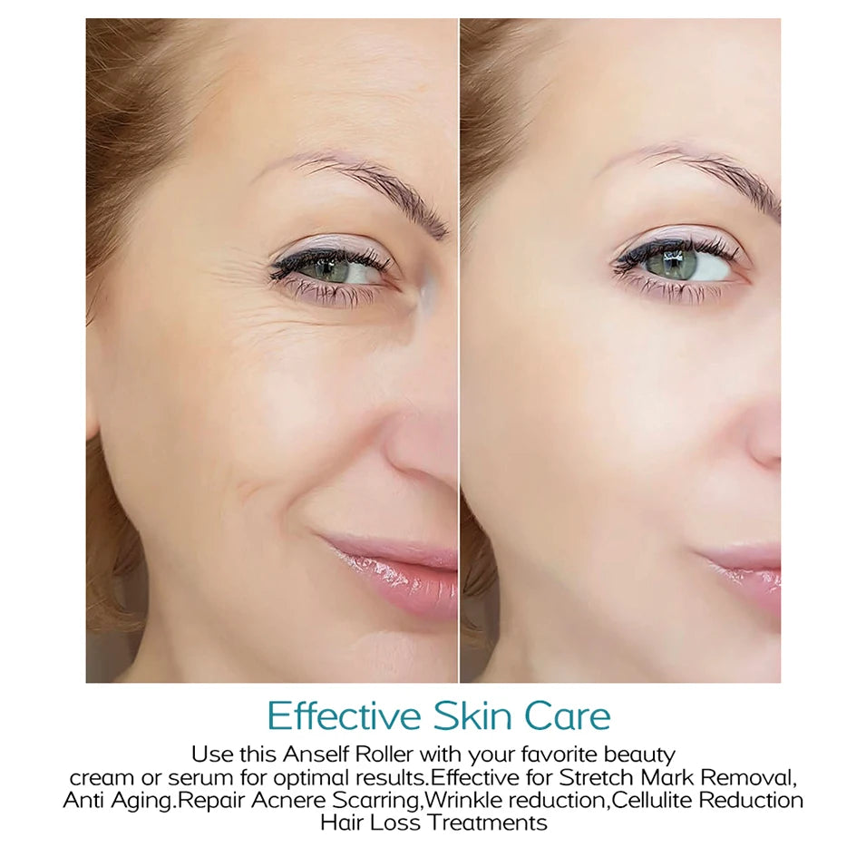 Professional Beauty Derma Roller Micro Face Roll Hair Growth For Skin Facial Hair Beard Scalp Micro Needle Face Roller Skin Care