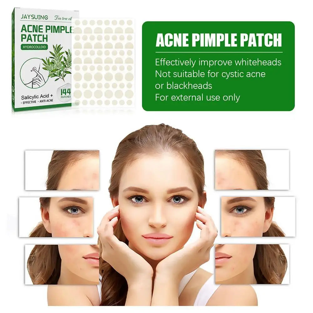 144pcs Acne Pimple Patches Translucent Matte Hydrocolloid Salicylic Acid Tea Tree Oil For Inflamed Acne Improve Whiteheads
