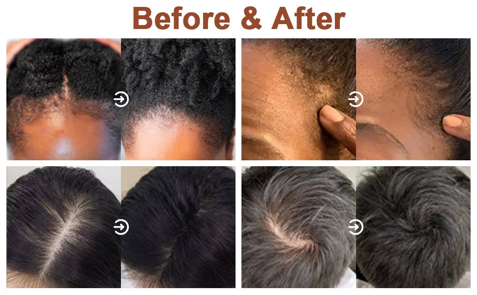 3pcs/set Hair Care Products for Women Moisturize Nourish Rosemary Oil Natural Batana Oil & Chebe Serum Anti-frizz Treatment Hair