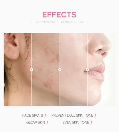 LAIKOU Sakura Skin Care Set Facial Cleanser Face Cream Essence Facial  Eye Cream Skincare Product 4pcs Kit