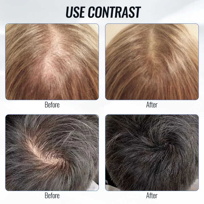 Scalp Applicator Liquid Comb For Hair Scalp Treatment Essential Oil Guiding Massager Brush Hair Growth Serum Oil Apply Device