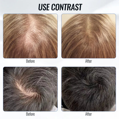 Scalp Applicator Liquid Comb For Hair Scalp Treatment Essential Oil Guiding Massager Brush Hair Growth Serum Oil Apply Device