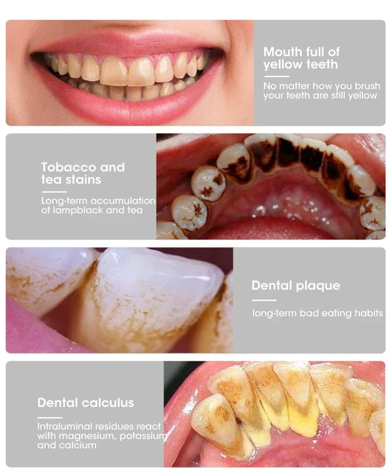 Electric Toothbrush Sonic Dental Teeth Whitening Kit Tooth Whitener Calculus Tartar Remover Tools Cleaner Stain Oral Care