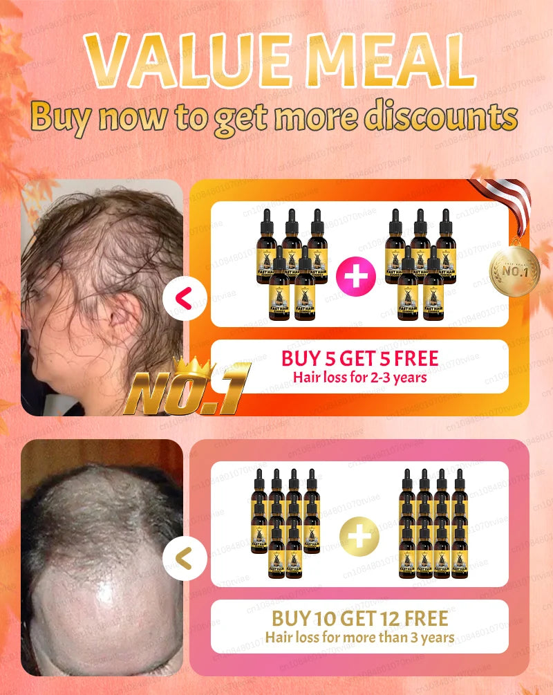 2025 Hair growth oil, repair baldness, hairline, rapid hair growth hair growth oil for men