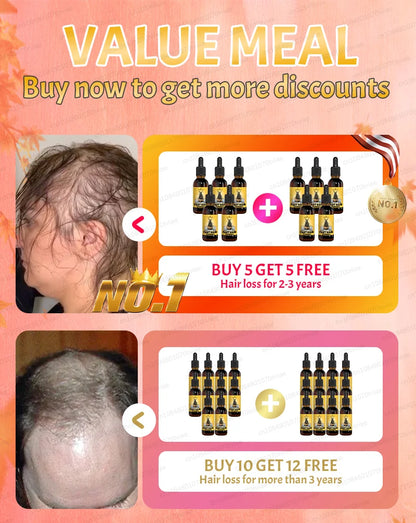 2025 Hair growth oil, repair baldness, hairline, rapid hair growth hair growth oil for men
