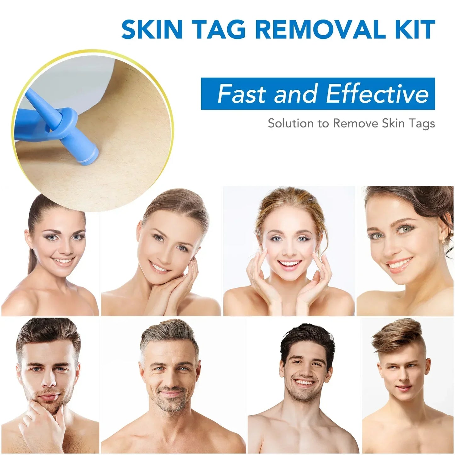 Simple Wart Removal Tool Set Skin Tag Removeal Tool Easy To Clean Skin Care Tool Skin Tag Removal Care Products
