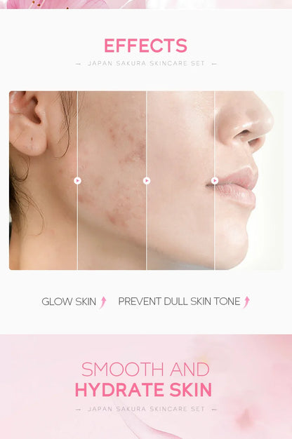 LAIKOU Sakura Kit Skin Care Sets Moisturizing and Reducing Fine Lines Cleansing Pore Product 5-Piece Korean Skincare Set