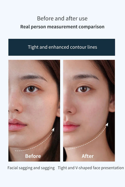 4D Roller Facial Massager EMS Face Lift Device V-Face Slimmer Skin Tightening Double Chin Remover Eye Care Vibration Massager