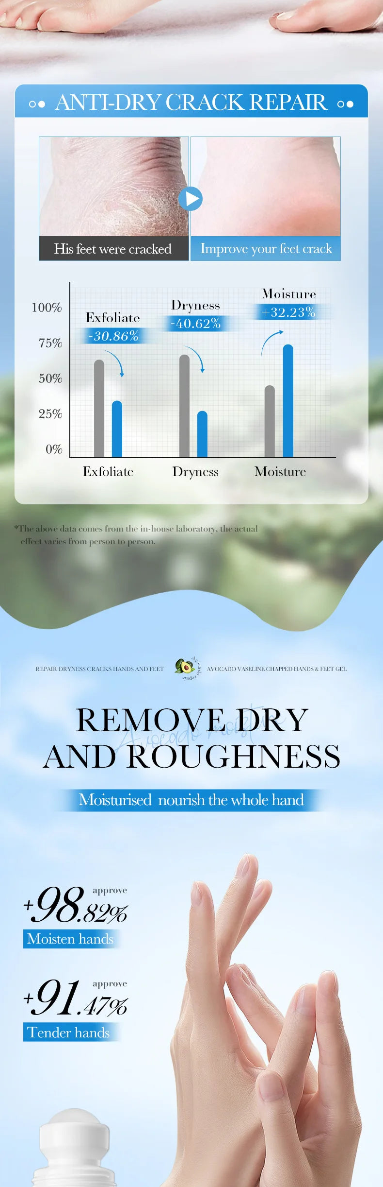 Avocado Hand and Foot Cream Condensation Bead Rolling Creams Moisturizing Nourishing Repairing Feet Hands skincare Creams