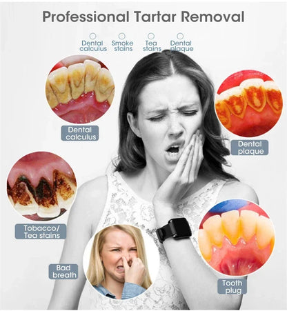 Electric Toothbrush Sonic Dental Teeth Whitening Kit Tooth Whitener Calculus Tartar Remover Tools Cleaner Stain Oral Care