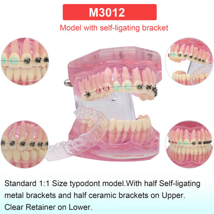 Dental Teeth Model Dental Teaching Models Implant Model Removable Dentistry Model Teeth For Training Studying Patient Education