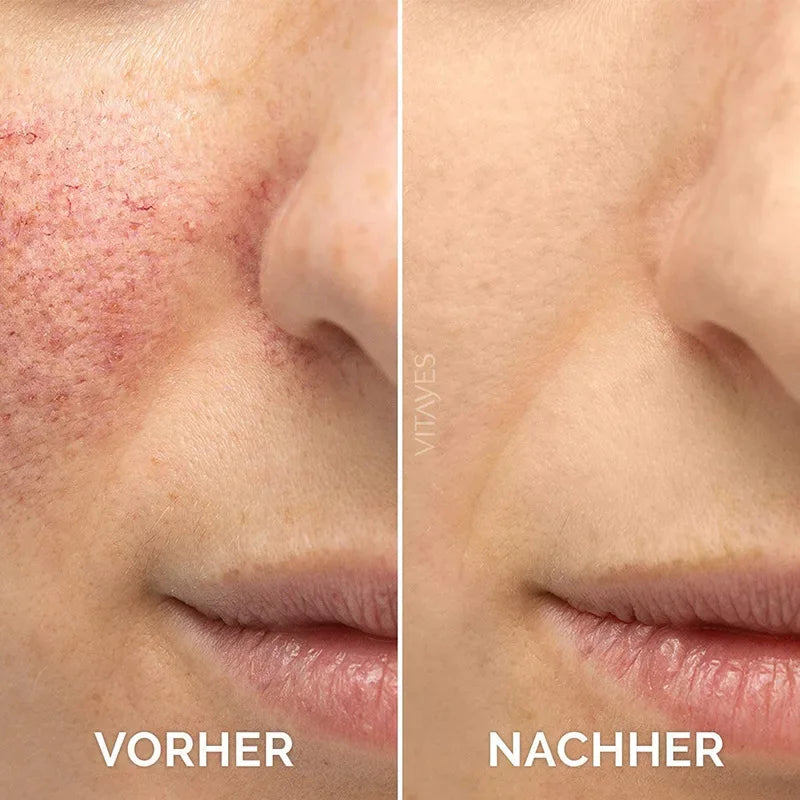 Vitamin C Facial Serum Essence, 30ml  Skincare Cleanser-B3 Gentle Acne Firming Improve dullness Vitamin C Serum stock solution