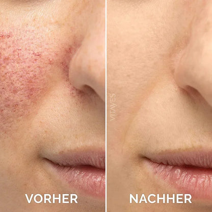 Vitamin C Facial Serum Essence, 30ml  Skincare Cleanser-B3 Gentle Acne Firming Improve dullness Vitamin C Serum stock solution