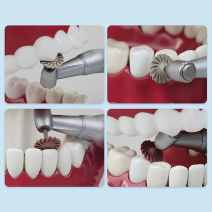 ELIJAH Dental Composite Resin Polishing Disc Kit Composite Resin Self-Glazed Polishing Disc Wheel For Tooth Whitening Materials