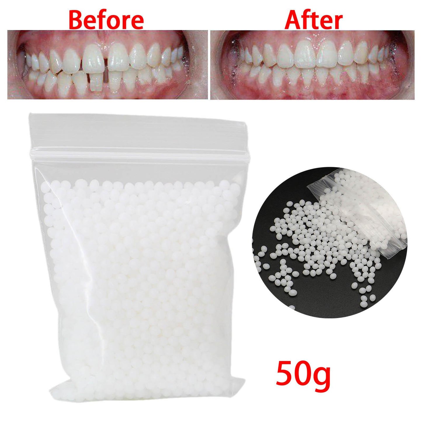 50G Temporary Tooth Repair Kit Teeth Gaps Filling Fix Missing Broken Teeth Moldable False Teeth Tooth Repair Teeth Veneers White