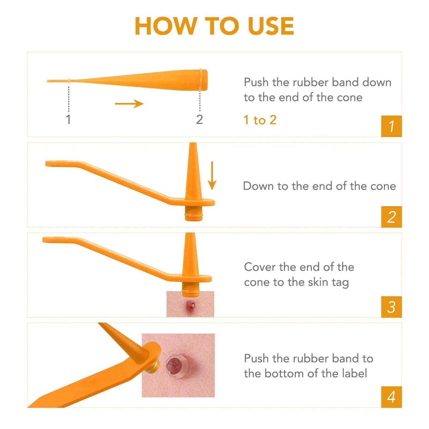 Simple Wart Removal Tool Set Skin Tag Removeal Tool Easy To Clean Skin Care Tool Skin Tag Removal Care Products