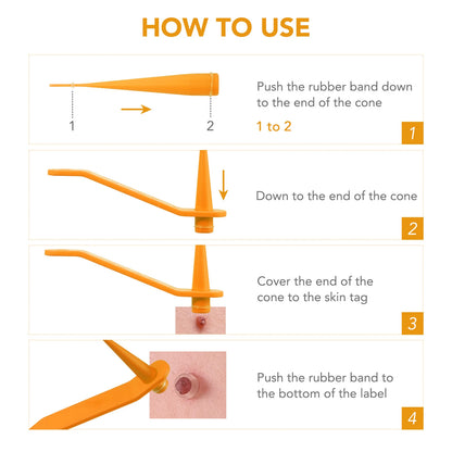 Simple Wart Removal Tool Set Skin Tag Removeal Tool Easy To Clean Skin Care Tool Skin Tag Removal Care Products