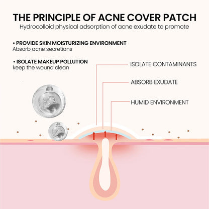 240pcs Pimple Patches Salicylic Acid Tea Tree Hydrocolloid Acne Patches Cute Star Pimple Patches for Healing Zit Patch