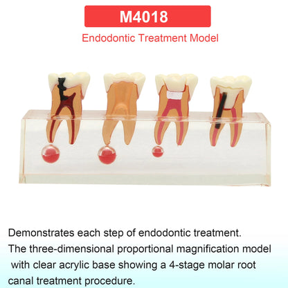 Dental Teeth Model Dental Teaching Models Implant Model Removable Dentistry Model Teeth For Training Studying Patient Education