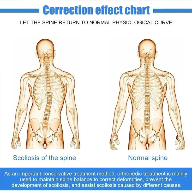 Fixed Spinal Brace Aluminium Alloy Breathable Fixed Spinal Straightener Brace for Children Adults Scoliosis Correcting Brace