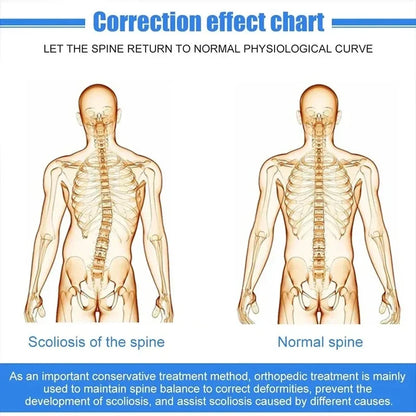 Fixed Spinal Brace Aluminium Alloy Breathable Fixed Spinal Straightener Brace for Children Adults Scoliosis Correcting Brace