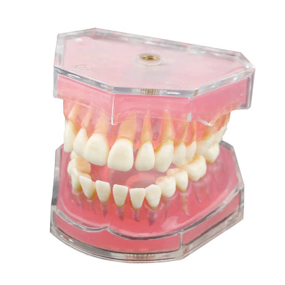 Dental Standard Typodont  Model Soft Gum  With 28 Removable Teeth Adult for Study Demo Teaching