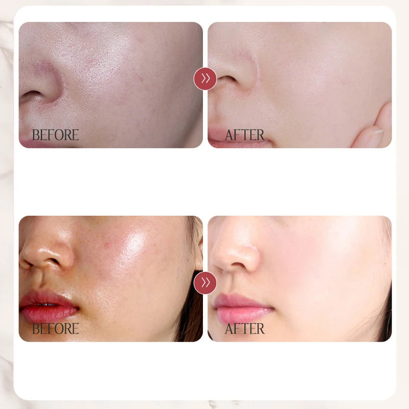 Beauty Rice Honey Facial Skincare 3pieces Set Moisturizing Arbutin Serum Milk Toner Smear Glow Mask Korean Brand Facial Skincare