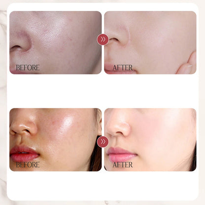 Beauty Rice Honey Facial Skincare 3pieces Set Moisturizing Arbutin Serum Milk Toner Smear Glow Mask Korean Brand Facial Skincare