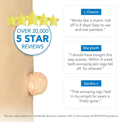 Simple Wart Removal Tool Set Skin Tag Removeal Tool Easy To Clean Skin Care Tool Skin Tag Removal Care Products