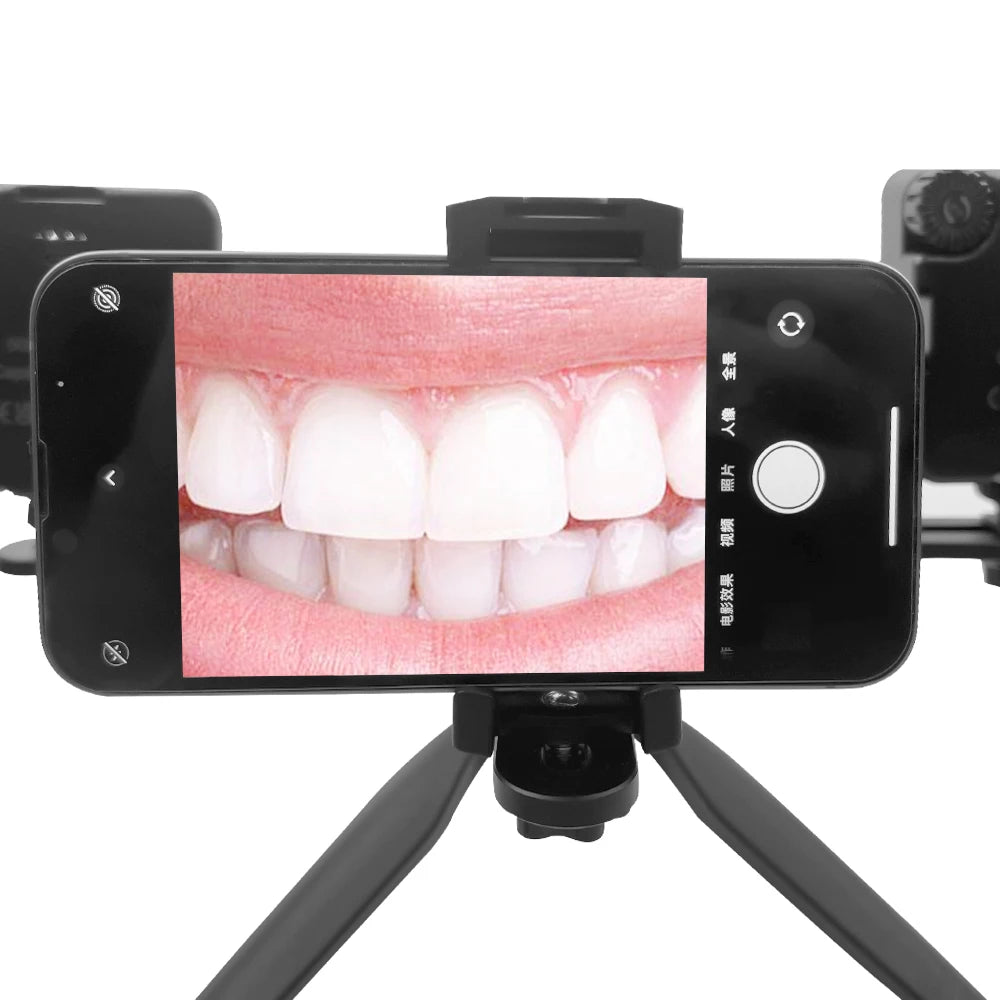 Dental Photography LED Oral Filling Light Intraoral Filling Lamp For Dentist Treatment Mobile Phone Flashlight Lighting Clinic