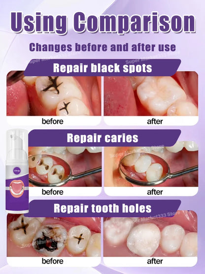 Solve all dental problem tooth decay repair tooth repair fast teeth whitening clean teeth teeth repair cavities