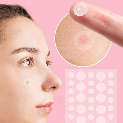 36pcs Blemish Patches Invisible Acne Dots Pimple Patches Hydrocolloid Acne Spot Patches Zit Stickers For Face