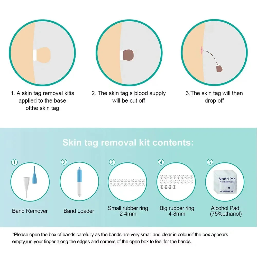 Skin Tag Removal Tool Rubber Rings Face Beauty Accessories Skin Tag Removal Device Multipurpose Supplies for Face Neck Chin Back