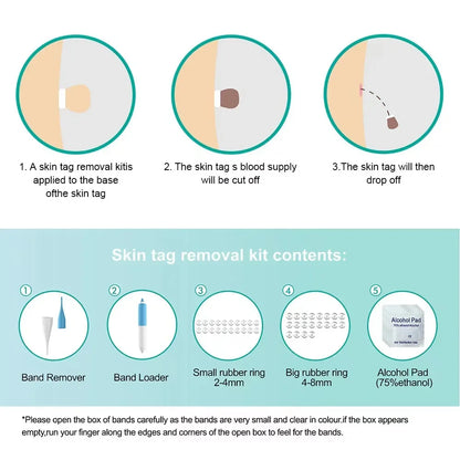 Skin Tag Removal Tool Rubber Rings Face Beauty Accessories Skin Tag Removal Device Multipurpose Supplies for Face Neck Chin Back